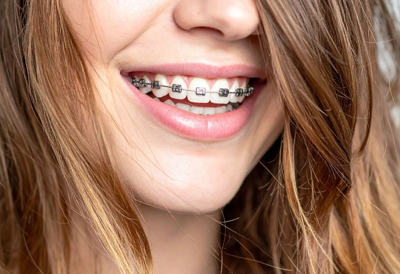 Sonrisa del paciente después de una endodoncia exitosa
