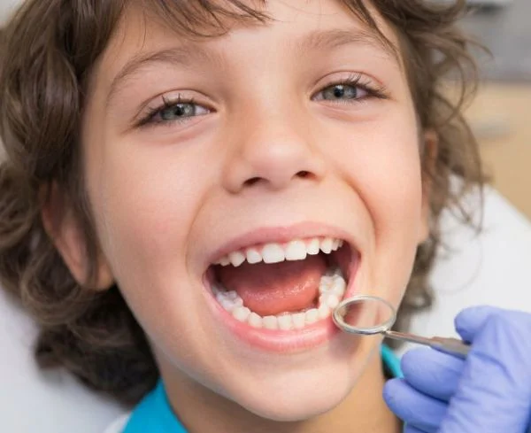 Niña mostrando un diente de leche caído tras un traumatismo dental en la clínica Multiestetik