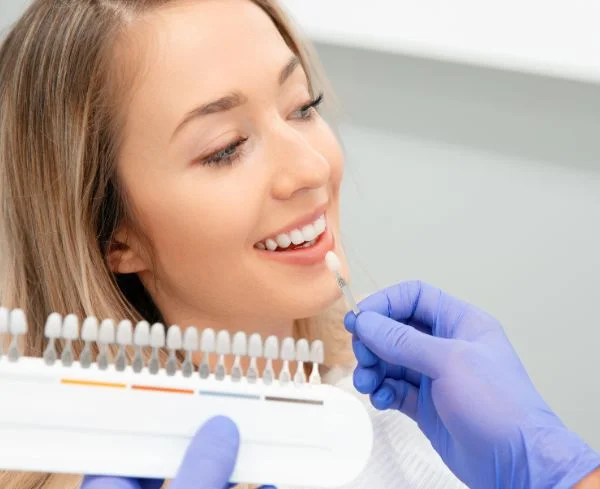 Carillas dentales para mejorar la estética y armonía de la sonrisa