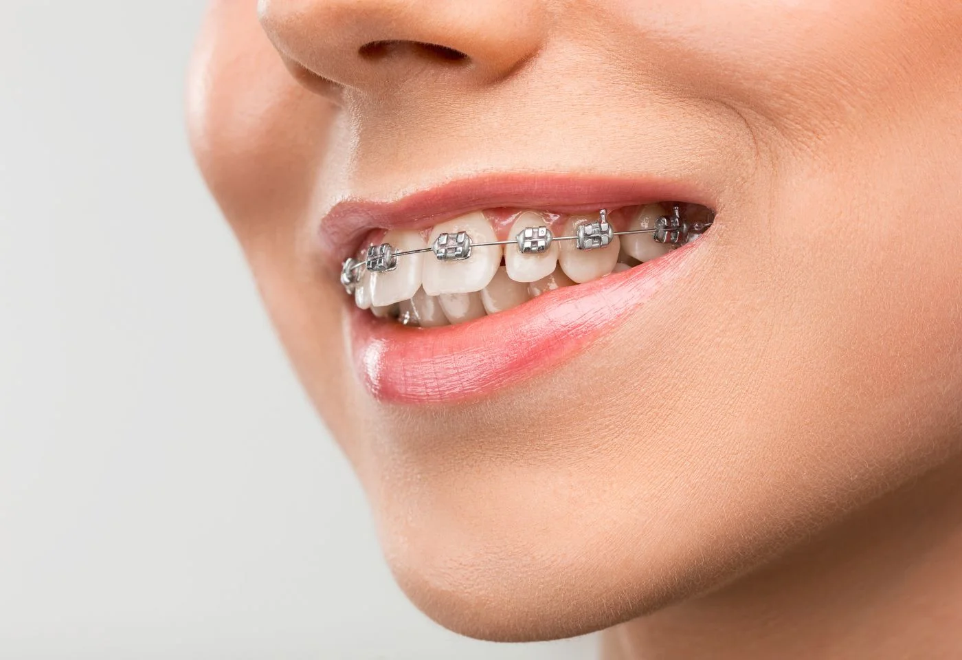 Sonrisa del paciente después de una endodoncia exitosa