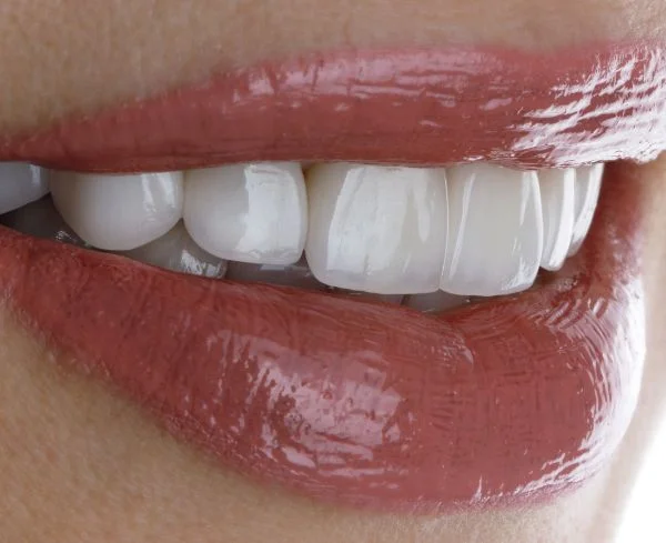 Tratamiento de estética de encías para mejorar la armonía entre dientes y encías